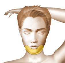Lipoaspiration-intervention